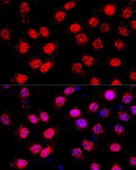 Polyclonal Rabbit anti-Human CXCR4 Antibody (IF, WB)