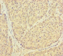 Polyclonal Rabbit anti-Human PSMF1 Antibody (aa1-271)