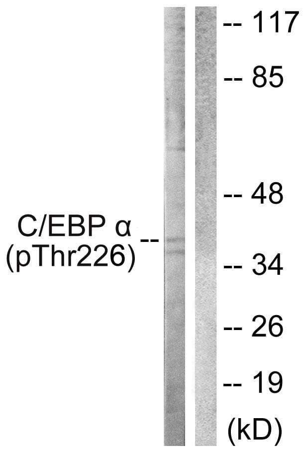 C/EBP Alpha / CEBPA Antibody (phospho-Thr226)