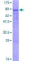 Human PFKFB4 Protein (Recombinant GST)