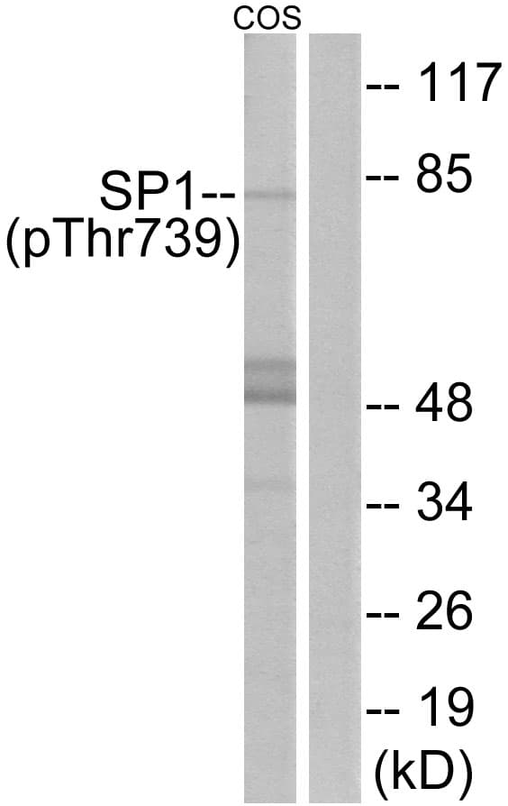 Polyclonal Rabbit anti-Human SP1 Antibody (phospho-Thr739, WB)