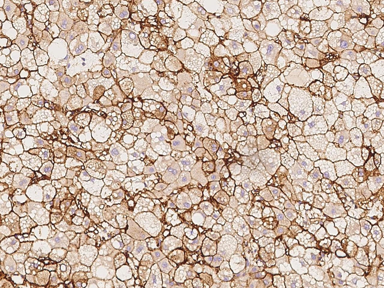 MHC Class I Antigen (HLA-B) Antibody (Preservative Free)