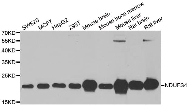 Polyclonal Rabbit anti-Human NDUFS4 Antibody (IHC, IF, WB)