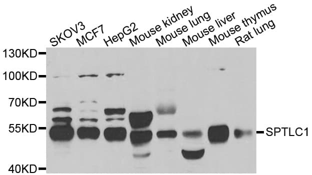 Polyclonal Rabbit anti-Human SPTLC1 / HSN1 Antibody (IHC, WB)