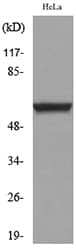 TP63 / p63 Antibody