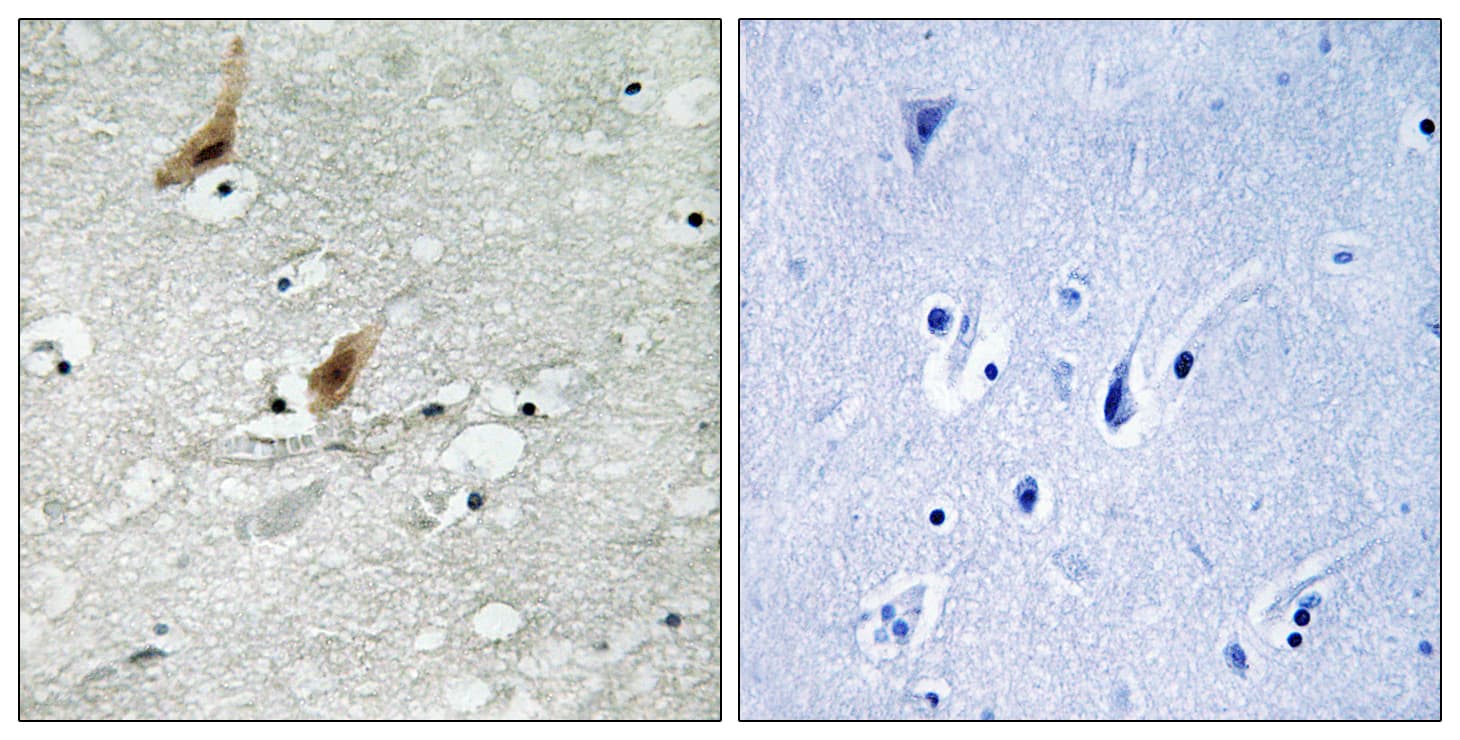 Polyclonal Rabbit anti-Human RPS6KA4 / MSK2 / RSK-B Antibody (phospho-Thr568, IHC, WB)