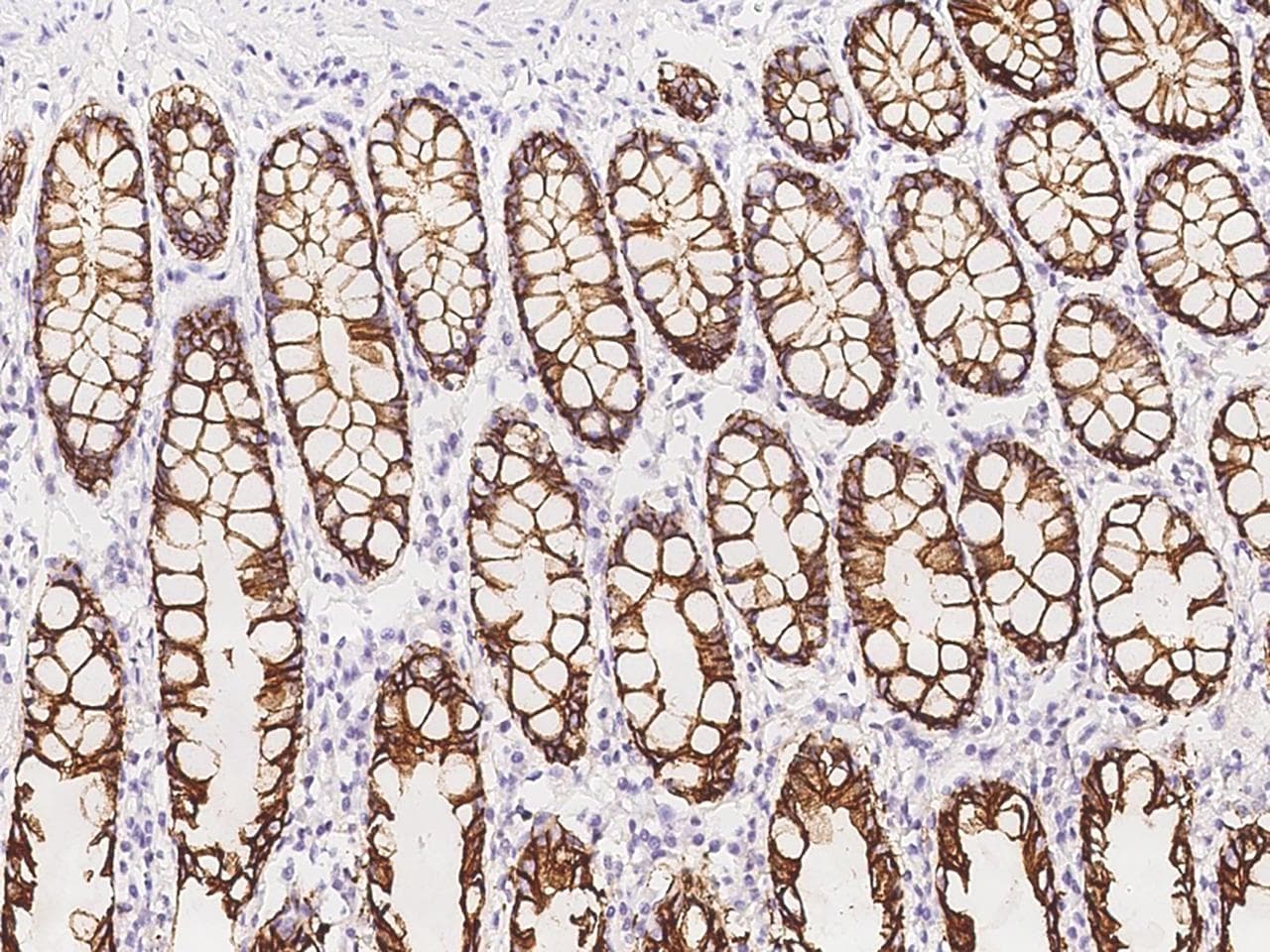 GPA33 / A33 Antibody