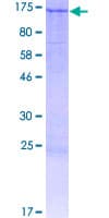 Human BNC1 / Basonuclin Protein (Recombinant GST)
