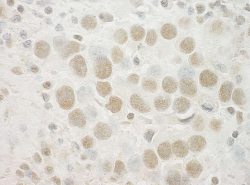 Polyclonal Rabbit anti-Human NCKIPSD / AF3P21 Antibody (aa600-650, IHC)
