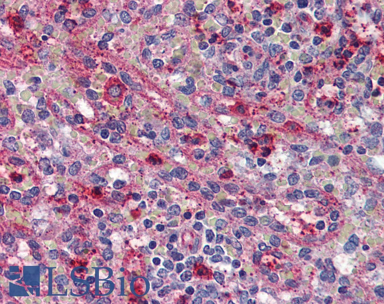 IHC-plus™ ACVR1C / ALK7 Antibody (Internal)