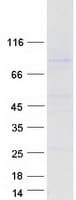 Human URI1 / NNX3 Protein (Recombinant Myc-DDK (Flag))