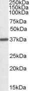 IHC-plus™ ARG1 / Arginase 1 Antibody (aa311-324)