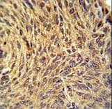 NUP210 / gp210 Antibody (aa202-231)
