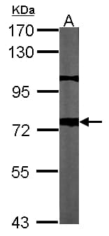 Beta Amyloid Antibody