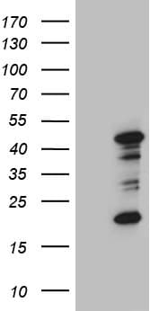 Monoclonal Mouse anti-Human MOK / RAGE Antibody (clone OTI7F4, Carrier-free, aa205-419, WB)