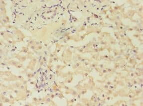 GRK4 Antibody (aa1-245)