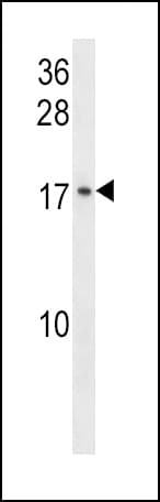 Polyclonal Rabbit anti-Human CR6 / GADD45G Antibody (aa1-30, WB)
