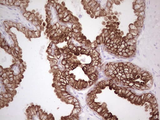 ABCB1 / MDR1 / P Glycoprotein Antibody (aa995-1280, clone OTI8A9)
