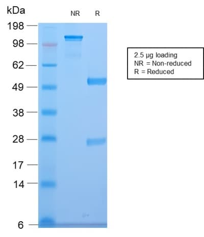 CELA3B / ELA3B Antibody (aa 82-238, clone CELA3B/2810R, Azide-free, Carrier-free)