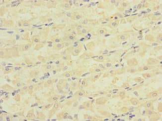ATRN / Attractin Antibody