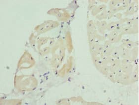 Polyclonal Rabbit anti-Human BAP29 / BCAP29 Antibody (IHC, WB)
