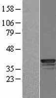 CTSL / Cathepsin L Protein (Over-Expression Lysate Myc-DDK (Flag))