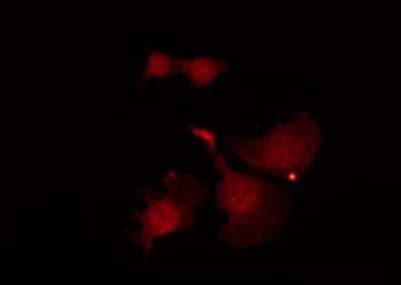 Polyclonal Rabbit anti-Human MAPK3 / ERK1 Antibody (IF, WB)