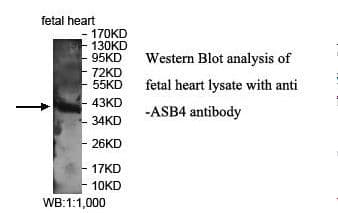 ASB4 Antibody (aa164-337)
