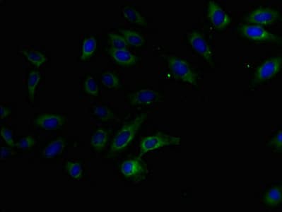 KIAA1467 Antibody