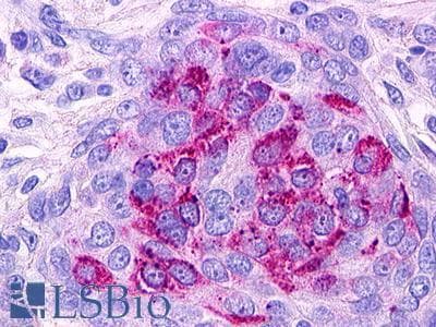 PathPlus™ Polyclonal Rabbit anti-Human S1PR1 / EDG1 / S1P1 Antibody (C-Terminus, IHC)