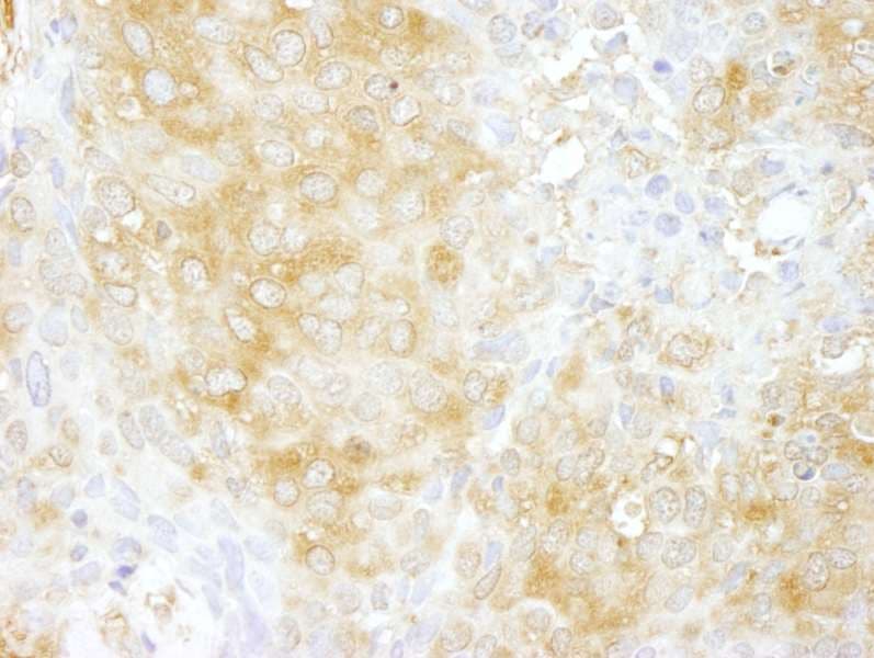 Polyclonal Rabbit anti-Human ARHGAP1 / CDC42GAP Antibody (aa1-50, IHC)
