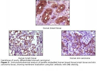 BLK Antibody (clone 9D10B7)