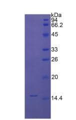 Mouse CTGF Protein (Recombinant His)