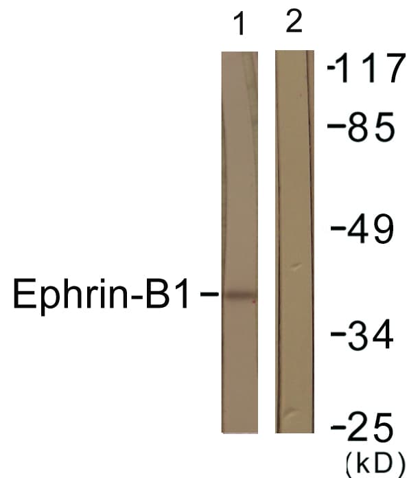 EFNB1 / Ephrin B1 Antibody (aa283-332)