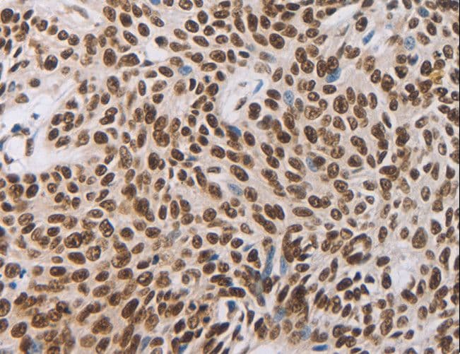 AKAP8 / AKAP95 Antibody