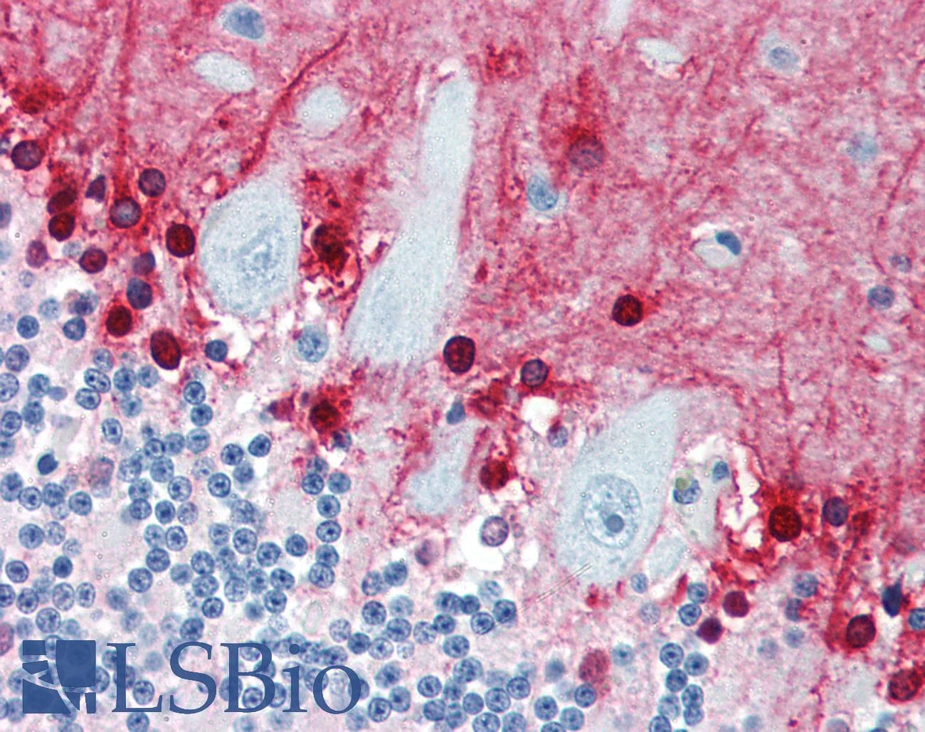 PathPlus™ S100B / S100 Beta Antibody (clone 9A11B9)