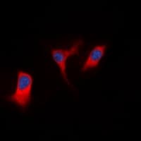 DAPK1 / DAP Kinase Antibody (Internal)