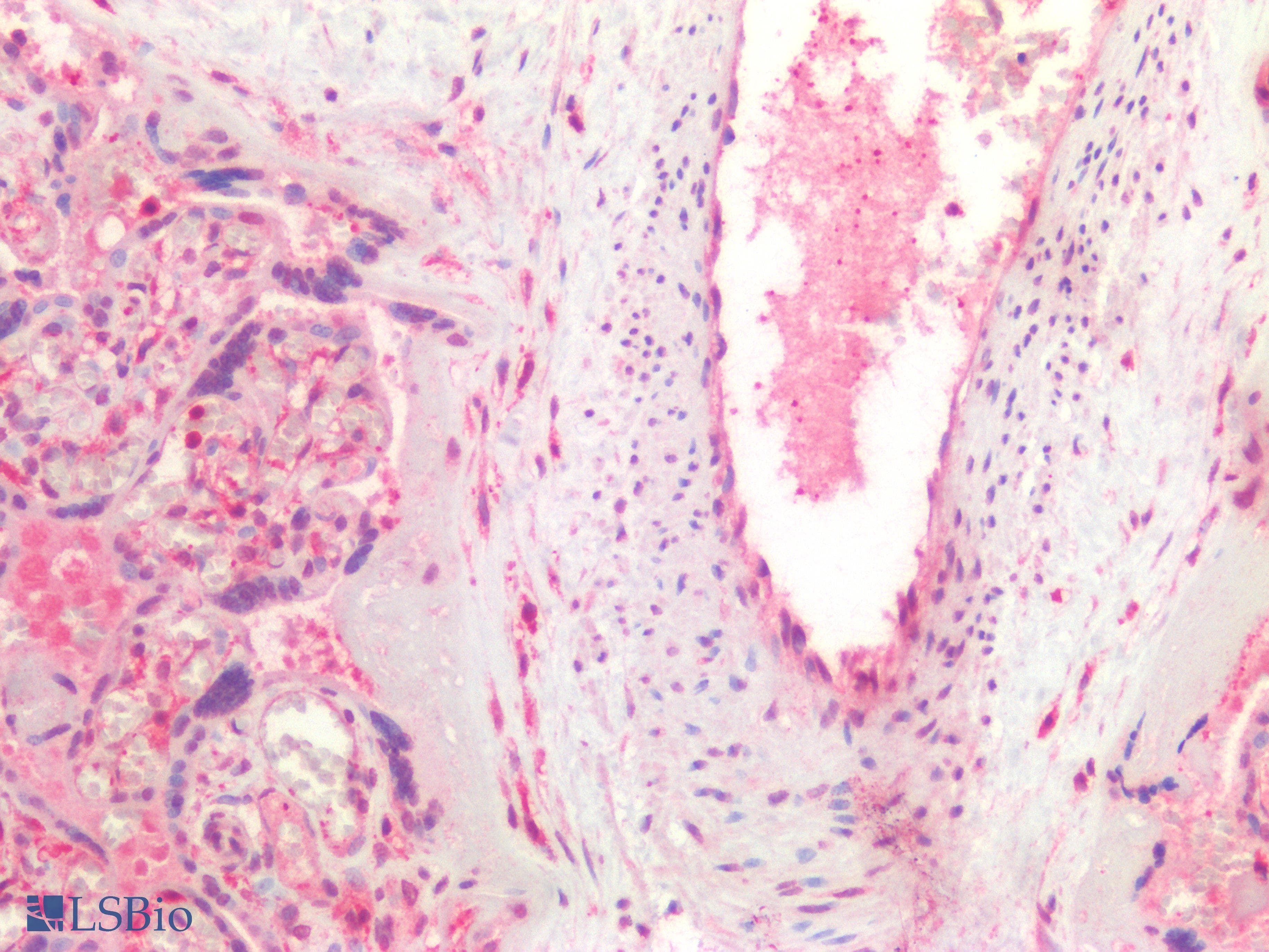 PathPlus™ VEGFA / VEGF Antibody