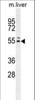 Polyclonal Rabbit anti-Human INSC Antibody (aa409-437, IHC, WB)