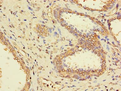PPP1CC / PP1 Gamma Antibody