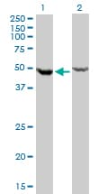 DDX6 Antibody (clone 3D2)