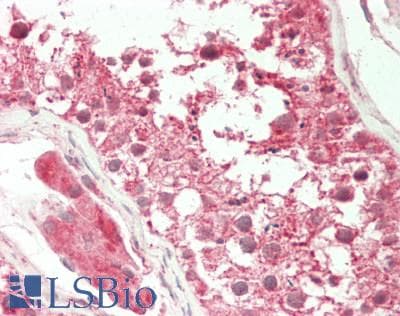 IHC-plus™ KAT5 / TIP60 Antibody (aa3-512)