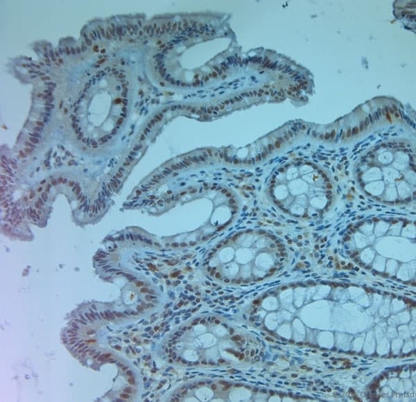 SLC11A2 / DMT1 Antibody