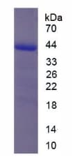 Chicken INHA / Inhibin Alpha Protein (Recombinant His-GST, N-terminus)