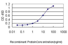IHC-plus™ SLC44A2 / CTL2 Antibody (clone 3D11)