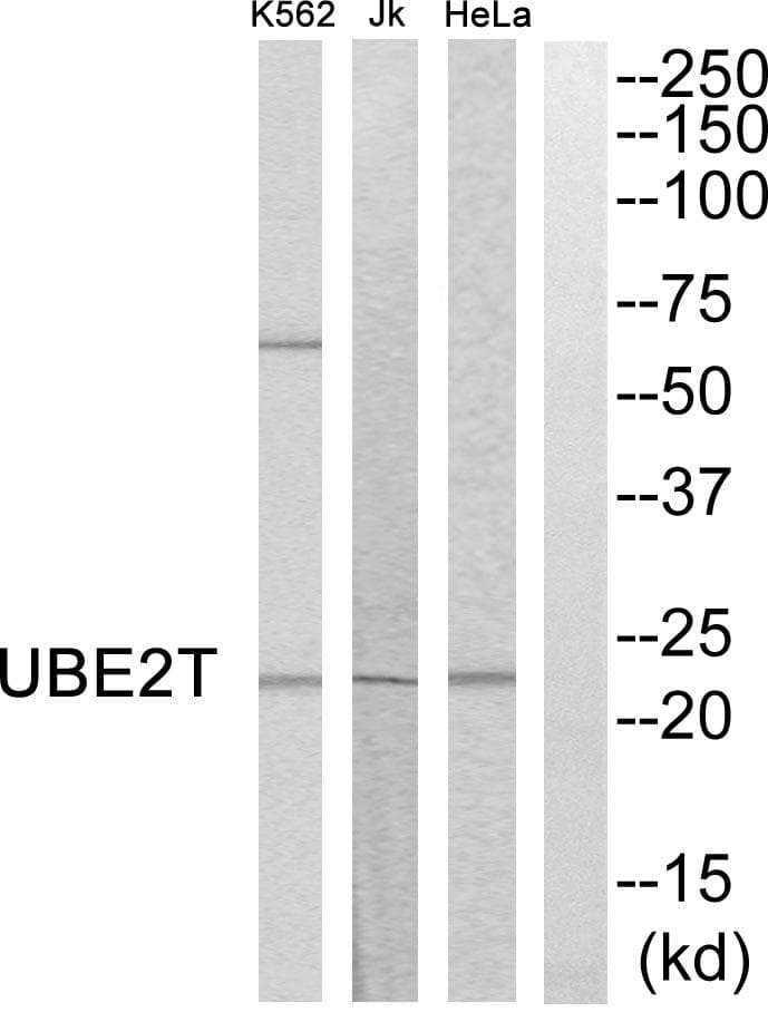 UBE2T / HSPC150 Antibody
