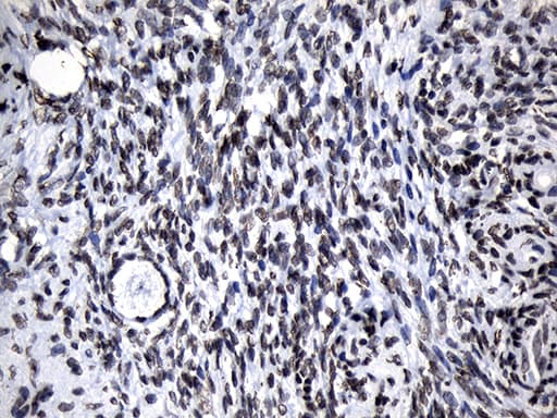 Monoclonal Mouse anti-Human ZNF705D Antibody (clone OTI1G1, IHC, WB)