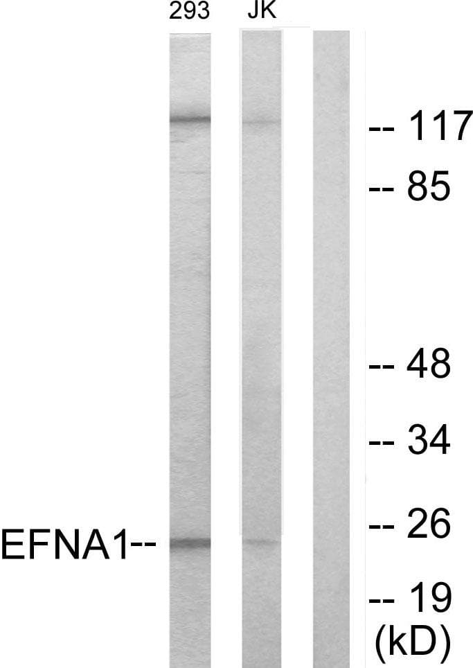 Polyclonal Rabbit anti-Human EFNA1 / Ephrin A1 Antibody (IF, WB)