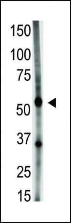 Polyclonal Rabbit anti-Human GDF5 / GDF-5 Antibody (aa13-41, IHC, WB)