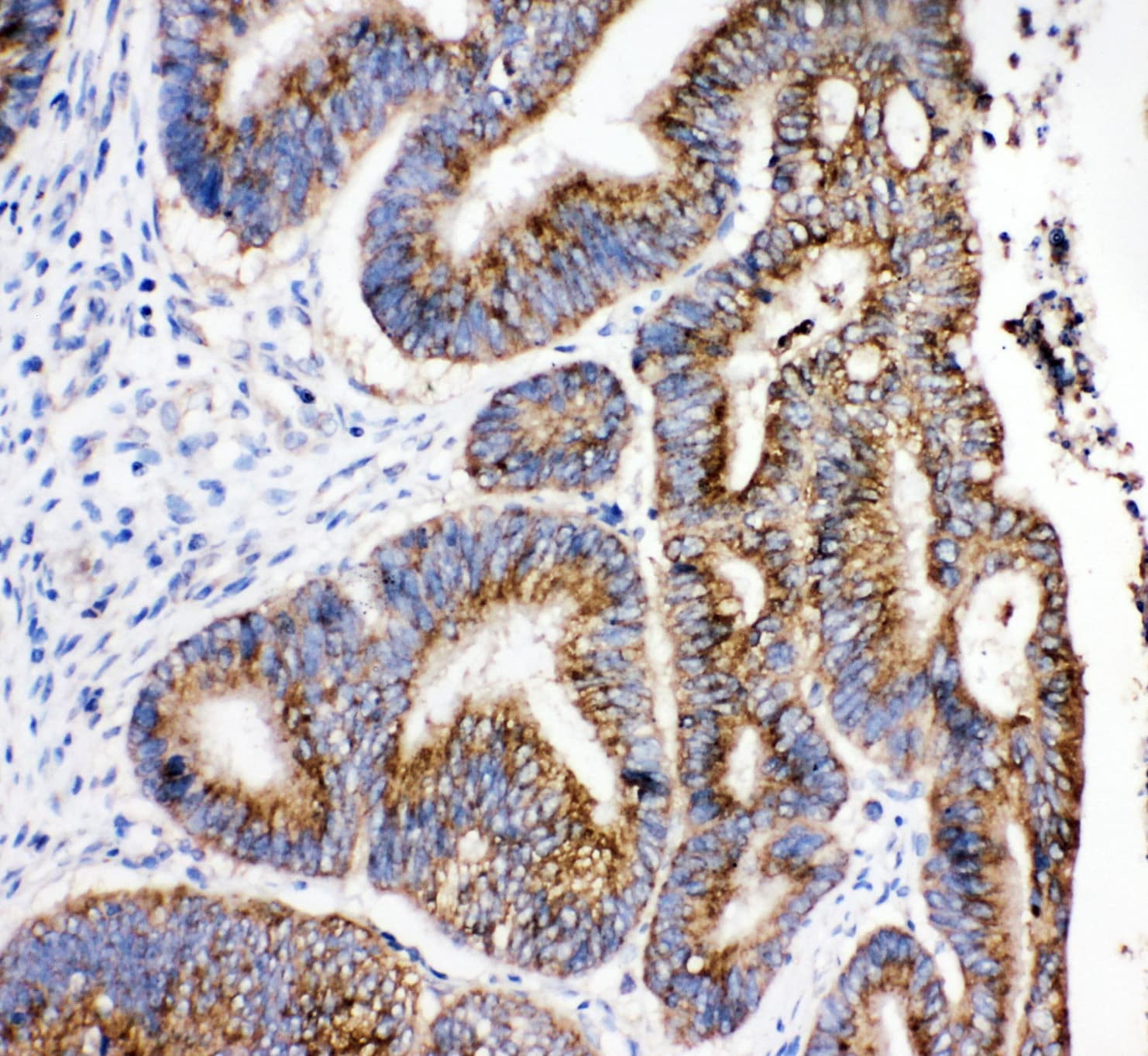 HSD17B4 Antibody (aa744-761)